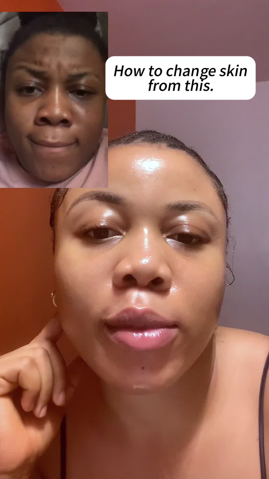 Qw Try it and say goodbye to your spots#foryou #freckles