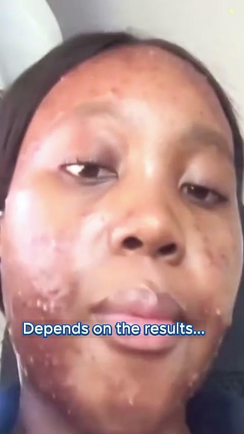 Vitamin C Essential Oil, try it now!