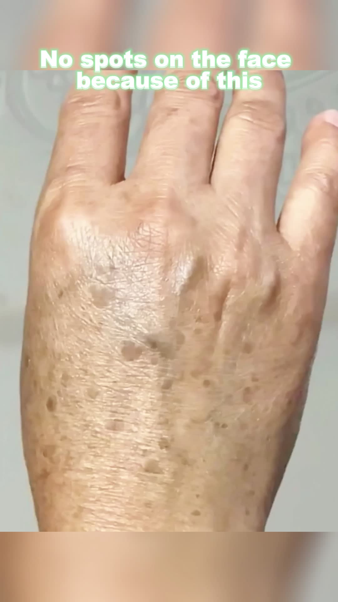 Qw Perfect solution for facial skin problems\n Try it now and see effective...#freckles #aobenz #fyp