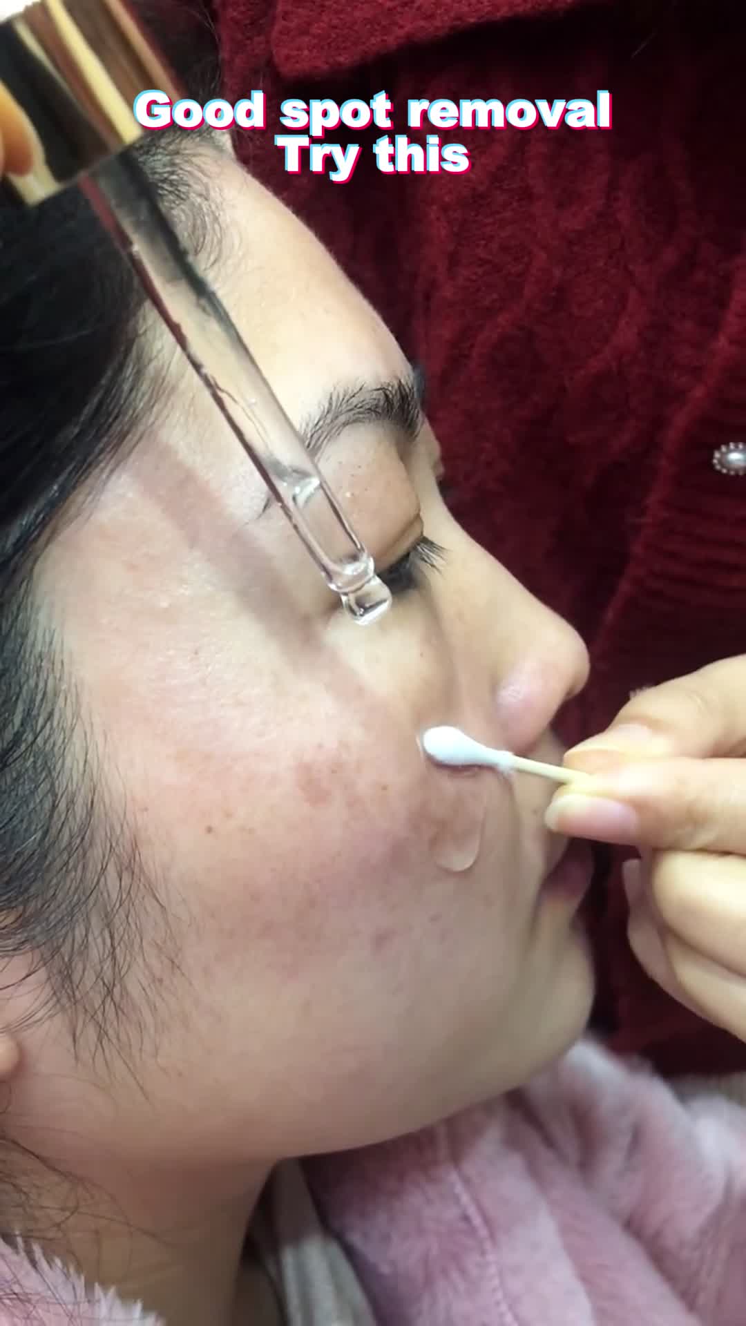 Qw Perfect solution for facial skin problems\n Try it now and see effective...#skin #spots #foryou