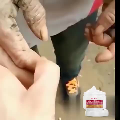 Krim Perbaikan Pelembab Kulit EELHOE untuk Tangan dan Kaki, Mengurangi Gatal, Melembapkan dan Menghidrasi Kulit Hand Perawatan Kering Berminyak