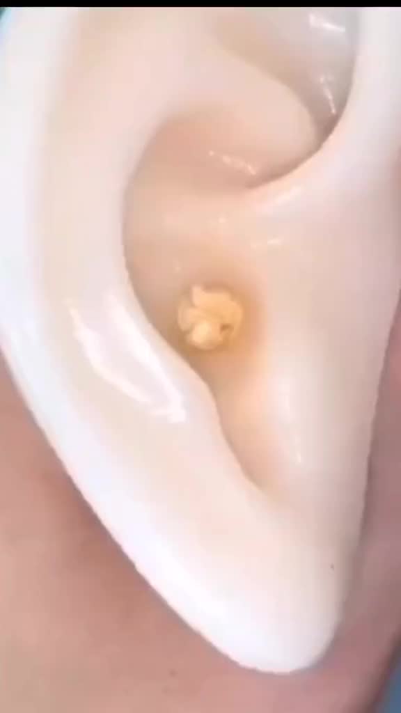 Pembersih telinga korek kuping